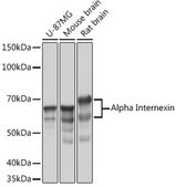 Anti-Alpha Internexin Antibody, clone 5E5Z3, Rabbit Monoclonal