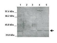 Anti-NFKBIA (ab1) antibody produced in rabbit affinity isolated antibody