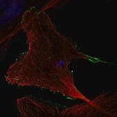 Anti-RHOBTB2 antibody produced in rabbit Prestige Antibodies&#174; Powered by Atlas Antibodies, affinity isolated antibody, buffered aqueous glycerol solution