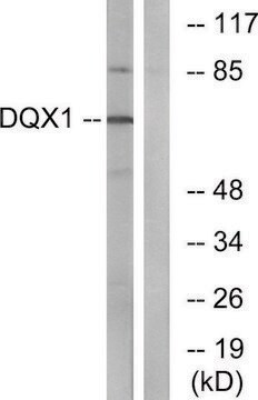 Anti-DQX1 antibody produced in rabbit affinity isolated antibody