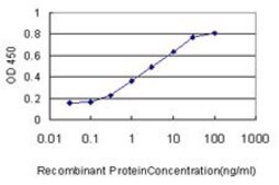Monoclonal Anti-ACYP1 antibody produced in mouse clone 1B2-3A2, purified immunoglobulin, buffered aqueous solution