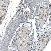 抗-MAT2A 兔抗 Prestige Antibodies&#174; Powered by Atlas Antibodies, affinity isolated antibody, buffered aqueous glycerol solution