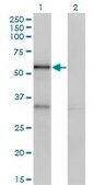 Monoclonal Anti-SERPINA10 antibody produced in mouse clone 1E11, purified immunoglobulin, buffered aqueous solution