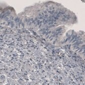 Monoclonal Anti-PGM1 antibody produced in mouse Prestige Antibodies&#174; Powered by Atlas Antibodies, clone CL3301, purified immunoglobulin