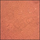 Human Fibroblast-Like Synoviocytes-Osteoarthritis: HFLS-OA, adult