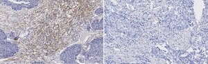 Anti-Zyxin Antibody, clone 2F17 ZooMAb&#174; Rabbit Monoclonal recombinant, expressed in HEK 293 cells