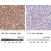 Anti-SLC17A7 antibody produced in rabbit Prestige Antibodies® Powered by Atlas Antibodies, affinity isolated antibody, buffered aqueous glycerol solution