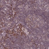 Anti-RPS19BP1 antibody produced in rabbit Prestige Antibodies&#174; Powered by Atlas Antibodies, affinity isolated antibody, buffered aqueous glycerol solution