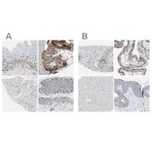 Anti-GRHL1 antibody produced in rabbit Ab1, Prestige Antibodies® Powered by Atlas Antibodies, affinity isolated antibody, buffered aqueous glycerol solution