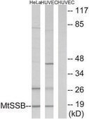 Anti-MTSSB antibody produced in rabbit affinity isolated antibody