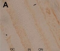 Anti-Na+K+ ATPase α-2 Antibody serum, Upstate®