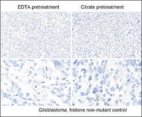Anti-Histone H3 K27M antibody, Rabbit Monoclonal recombinant, expressed in HEK 293 cells, clone RM192, purified immunoglobulin