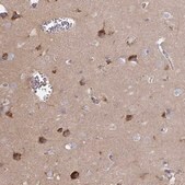 Anti-SLC9A6 antibody produced in rabbit Prestige Antibodies&#174; Powered by Atlas Antibodies, affinity isolated antibody, buffered aqueous glycerol solution