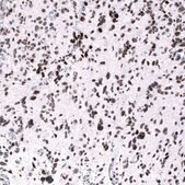 Monoclonal Anti-EZH2 antibody produced in mouse Prestige Antibodies&#174; Powered by Atlas Antibodies, clone CL11960, purified immunoglobulin, buffered aqueous glycerol solution