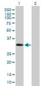Anti-SULT1B1 antibody produced in mouse IgG fraction of antiserum, buffered aqueous solution