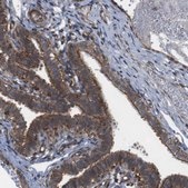 Anti-PTGER4 antibody produced in rabbit Prestige Antibodies® Powered by Atlas Antibodies, affinity isolated antibody, buffered aqueous glycerol solution