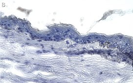 Anti-Collagen Type VII Antibody, clone 1E5 ZooMAb&#174; Rabbit Monoclonal recombinant, expressed in HEK 293 cells