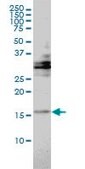 Monoclonal Anti-TRAPPC2 antibody produced in mouse clone 2E10, purified immunoglobulin, buffered aqueous solution
