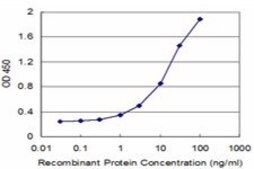 Monoclonal Anti-LMX1B, (N-terminal) antibody produced in mouse clone 1D12, purified immunoglobulin, buffered aqueous solution