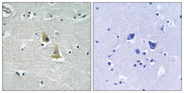 Anti-p47 PHOX, C-Terminal antibody produced in rabbit affinity isolated antibody