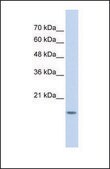 Anti-GABARAPL1 antibody produced in rabbit affinity isolated antibody