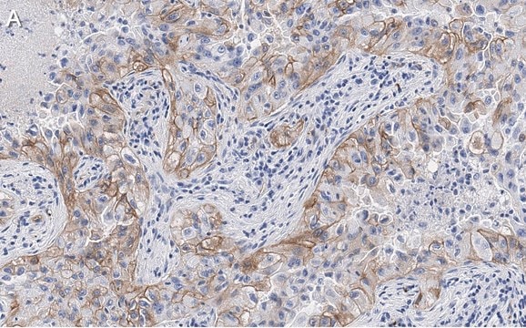 Anti-Integrin &#945;V&#946;3 Antibody, clone EM22703 ZooMAb&#174; Rabbit Monoclonal recombinant, expressed in HEK 293 cells