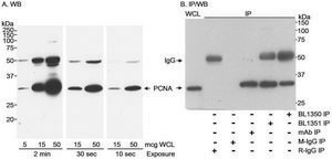 Rabbit anti-PCNA Antibody, Affinity Purified Powered by Bethyl Laboratories, Inc.
