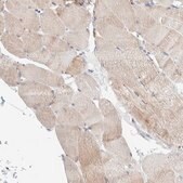 Anti-SLC38A10 antibody produced in rabbit Prestige Antibodies&#174; Powered by Atlas Antibodies, affinity isolated antibody, buffered aqueous glycerol solution, Ab3