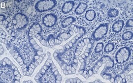 Anti-PTBP1/PTB Antibody, clone 1G23 ZooMAb&#174; Rabbit Monoclonal recombinant, expressed in HEK 293 cells