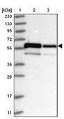 Anti-ZNF622 antibody produced in rabbit Prestige Antibodies&#174; Powered by Atlas Antibodies, affinity isolated antibody, buffered aqueous glycerol solution