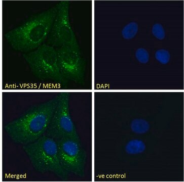 Anti-B5 Receptor/PCID1/EIF3M antibody produced in goat affinity isolated antibody, buffered aqueous solution