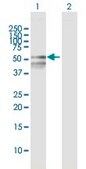 Anti-RBMY1F antibody produced in mouse IgG fraction of antiserum, buffered aqueous solution