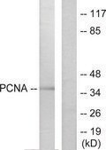 Anti-PCNA antibody produced in rabbit affinity isolated antibody