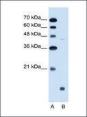 Anti-EDG8 (AB1) antibody produced in rabbit affinity isolated antibody