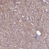 Anti-NDUFAF6 antibody produced in rabbit Prestige Antibodies® Powered by Atlas Antibodies, affinity isolated antibody, buffered aqueous glycerol solution