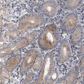 Anti-BTN2A1 antibody produced in rabbit Prestige Antibodies&#174; Powered by Atlas Antibodies, affinity isolated antibody, buffered aqueous glycerol solution