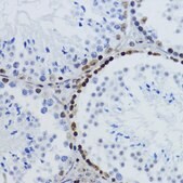 Anti-Acetyl-Histone H2B-K12 antibody produced in rabbit
