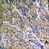 Anti-phospho-FOXO1A/3A (pSer322+Ser325) antibody produced in rabbit affinity isolated antibody
