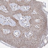 Anti-SNRNP27 antibody produced in rabbit Prestige Antibodies&#174; Powered by Atlas Antibodies, affinity isolated antibody, buffered aqueous glycerol solution