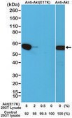 Anti-Akt (E17K Mutant) antibody, Rabbit monoclonal recombinant, expressed in HEK 293 cells, clone RM336, purified immunoglobulin