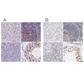 Anti-NASP antibody produced in rabbit Prestige Antibodies® Powered by Atlas Antibodies, affinity isolated antibody, buffered aqueous glycerol solution