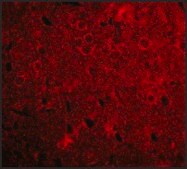 Anti-GPAT1 antibody produced in rabbit affinity isolated antibody, buffered aqueous solution