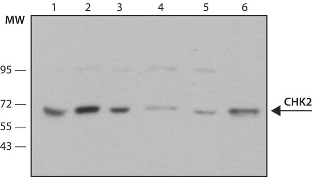 Anti-Chk2 antibody, Mouse monoclonal clone DCS-270, purified from hybridoma cell culture
