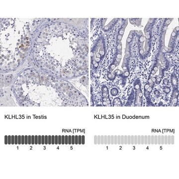 Anti-KLHL35 antibody produced in rabbit Prestige Antibodies&#174; Powered by Atlas Antibodies, affinity isolated antibody, buffered aqueous glycerol solution