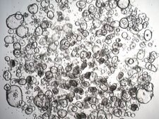 3dGRO Descending Colon Intestinal Organoids, Age 59 (Prep ht-215-CD) Normal, Colon Descending, Age: 59, Female, Mutation: None