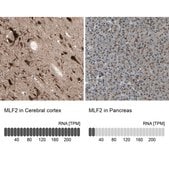 Anti-MLF2 antibody produced in rabbit Ab1, Prestige Antibodies® Powered by Atlas Antibodies, affinity isolated antibody, buffered aqueous glycerol solution