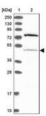 Anti-THUMPD2 antibody produced in rabbit Prestige Antibodies&#174; Powered by Atlas Antibodies, affinity isolated antibody, buffered aqueous glycerol solution