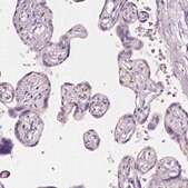 Anti-AWAT2 antibody produced in rabbit Prestige Antibodies&#174; Powered by Atlas Antibodies, affinity isolated antibody, buffered aqueous glycerol solution