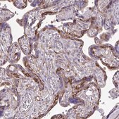 Anti-MYH10 antibody produced in rabbit Prestige Antibodies&#174; Powered by Atlas Antibodies, affinity isolated antibody, buffered aqueous glycerol solution