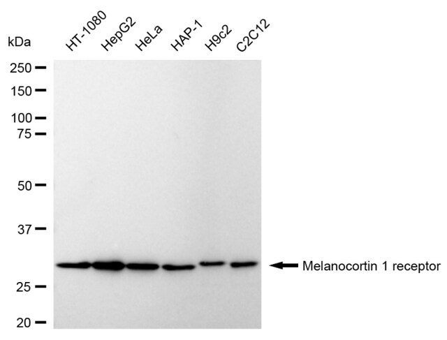 Anti Melanocortin 1 Receptor Antibody, clone 24GB640, Rabbit Monoclonal clone 24GB640, recombinant rabbit monoclonal, expressed in HEK293 cells
